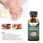 Prirodni Gel Protiv Gljivica na Noktima – Fungal Restore Gel za Negu Stopala i Noktiju (10ml)