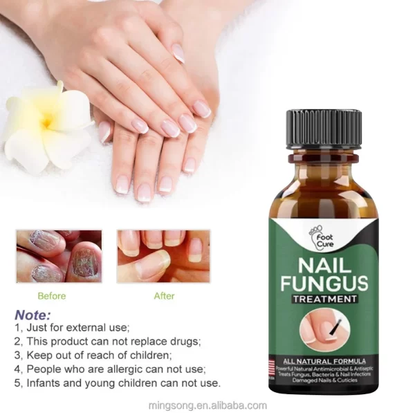 Prirodni Gel Protiv Gljivica na Noktima – Fungal Restore Gel za Negu Stopala i Noktiju (10ml)