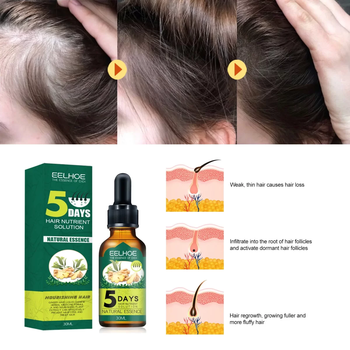 Ulje za Rast Kose – Prirodna Esencijalna Formula za Muškarce i Žene (30ml) - Image 3