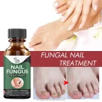 Prirodni Gel Protiv Gljivica na Noktima – Fungal Restore Gel za Negu Stopala i Noktiju (10ml) - Image 3
