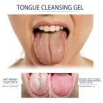 Eelhoe gel za čišćenje jezika – dubinska oralna nega - Image 2