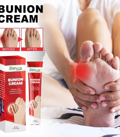 Krema za čukljeve EELHOE – za poboljšanu fleksibilnost i umanjenje otoka i bolova