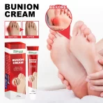 1+1 gratis - Krema za čukljeve EELHOE – za poboljšanu fleksibilnost i umanjenje otoka i bolova - Slika 3