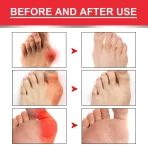 1+1 gratis - Krema za čukljeve EELHOE – za poboljšanu fleksibilnost i umanjenje otoka i bolova - Slika 6